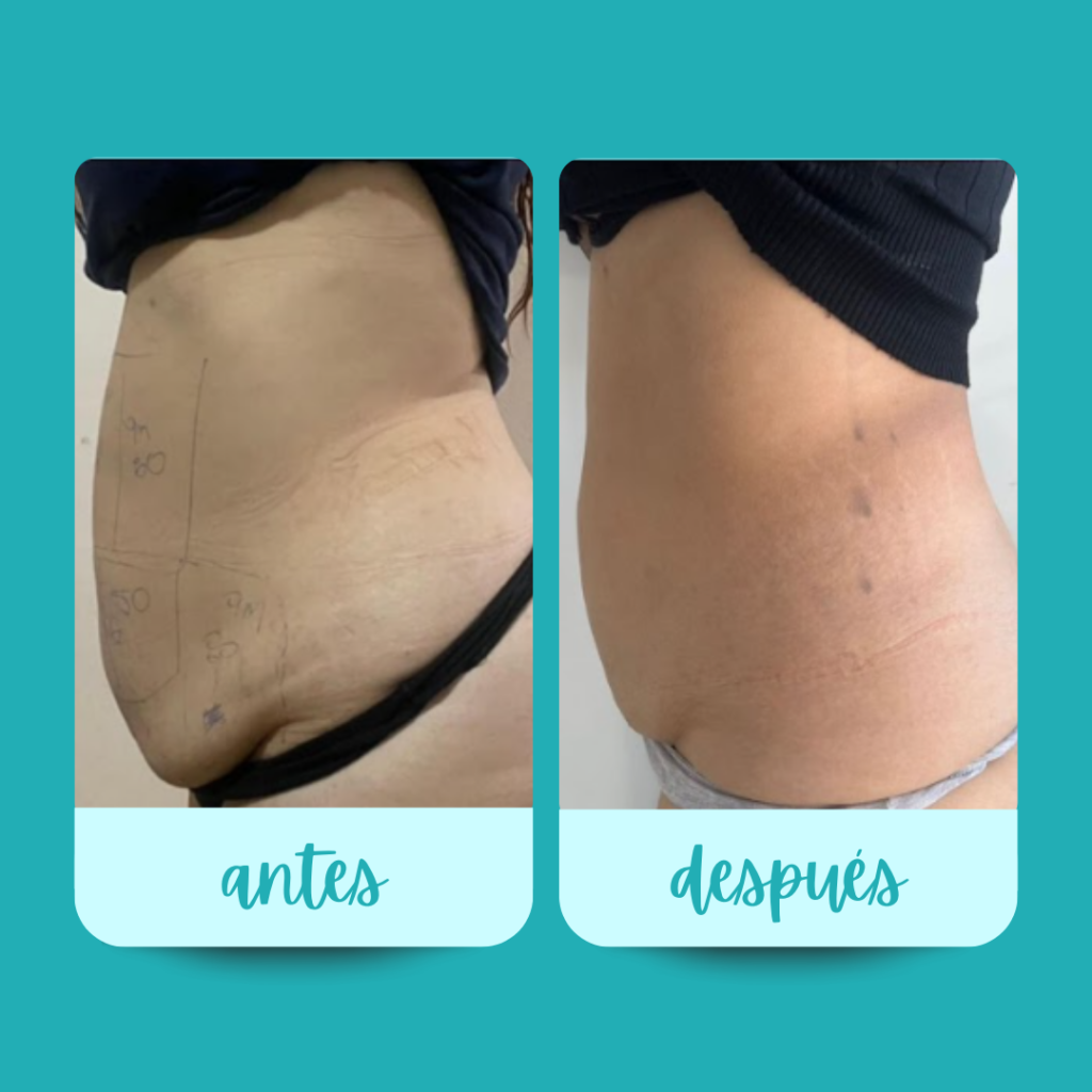 10_20251126_142420_0004