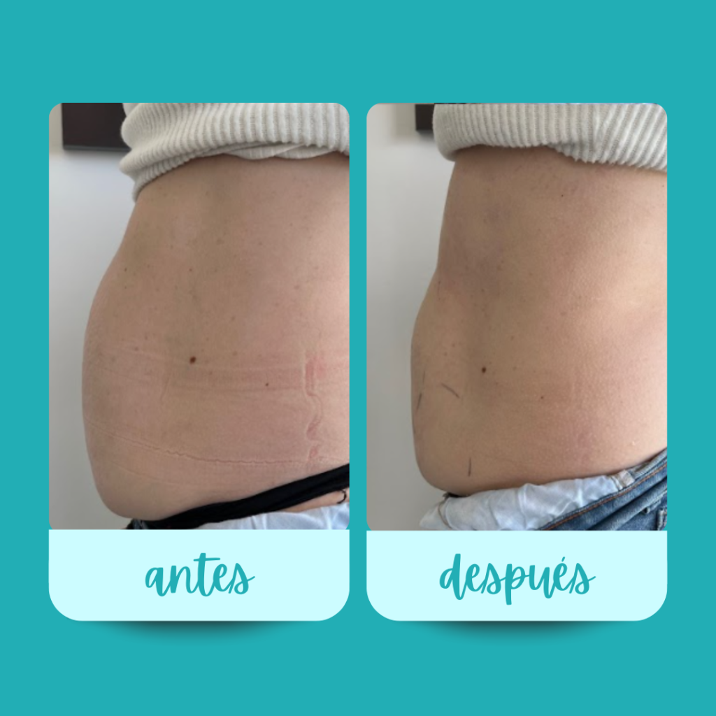 11_20251126_142421_0005