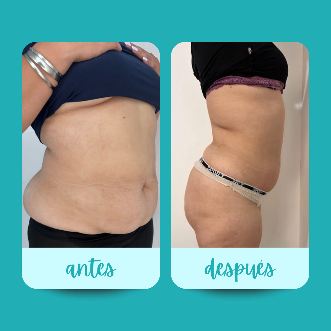 6_20251126_142420_0000